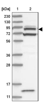 ACAP2 Antibody in Western Blot (WB)