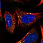 ACAP2 Polyclonal Antibody