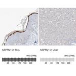 ASPRV1 Antibody in Immunohistochemistry (IHC)