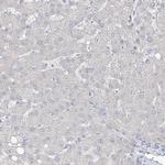 ASPRV1 Antibody in Immunohistochemistry (IHC)