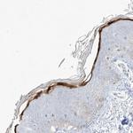 ASPRV1 Antibody in Immunohistochemistry (IHC)