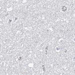 ASPRV1 Antibody in Immunohistochemistry (IHC)