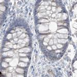 ASPRV1 Antibody in Immunohistochemistry (IHC)
