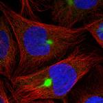 ZNF189 Polyclonal Antibody