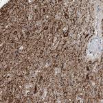 ZNF189 Antibody in Immunohistochemistry (Paraffin) (IHC (P))