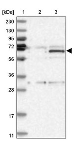 ZNF189 Antibody in Western Blot (WB)