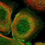 FBXO38 Polyclonal Antibody