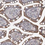 FBXO38 Antibody in Immunohistochemistry (Paraffin) (IHC (P))