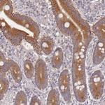 SLC35F5 Polyclonal Antibody