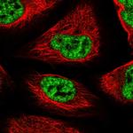 SF3B14 Polyclonal Antibody