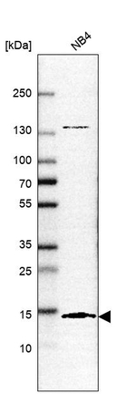 SF3B14 Antibody in Western Blot (WB)