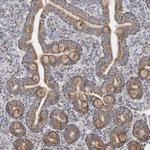 GTPBP8 Antibody in Immunohistochemistry (Paraffin) (IHC (P))
