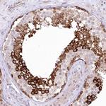 ZONAB Antibody in Immunohistochemistry (Paraffin) (IHC (P))
