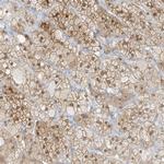 ZBTB41 Polyclonal Antibody