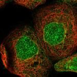 ZBTB41 Polyclonal Antibody