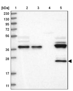 ZFAND6 Antibody in Western Blot (WB)