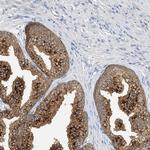 POMGNT2 Polyclonal Antibody