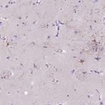 MYH15 Antibody in Immunohistochemistry (Paraffin) (IHC (P))