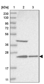 UQCC1 Antibody in Western Blot (WB)
