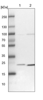 UQCC1 Antibody in Western Blot (WB)