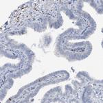 ZCCHC12 Antibody in Immunohistochemistry (Paraffin) (IHC (P))