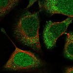 ACYP1 Polyclonal Antibody