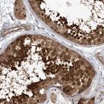 ACYP1 Antibody in Immunohistochemistry (Paraffin) (IHC (P))