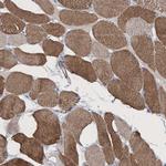 RTN2 Polyclonal Antibody