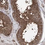PRSS53 Polyclonal Antibody