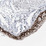 SLC25A53 Polyclonal Antibody