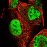 ARGLU1 Polyclonal Antibody