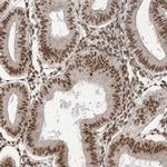 ARGLU1 Antibody in Immunohistochemistry (IHC)