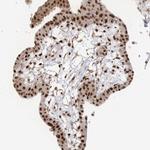ARGLU1 Antibody in Immunohistochemistry (IHC)