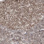 ARGLU1 Antibody in Immunohistochemistry (IHC)