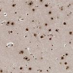 ARGLU1 Antibody in Immunohistochemistry (IHC)
