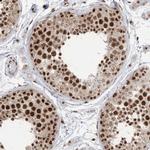 ARGLU1 Antibody in Immunohistochemistry (IHC)