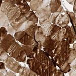 TAB3 Polyclonal Antibody