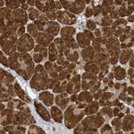 TAB3 Antibody in Immunohistochemistry (Paraffin) (IHC (P))
