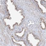 AFTPH Antibody in Immunohistochemistry (Paraffin) (IHC (P))