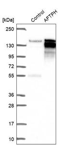 AFTPH Antibody in Western Blot (WB)
