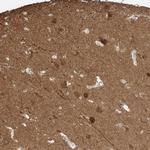 LANCL1 Antibody in Immunohistochemistry (IHC)