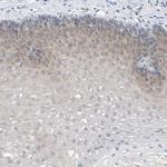 LRRC29 Polyclonal Antibody