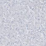 SEMA3F Antibody in Immunohistochemistry (Paraffin) (IHC (P))