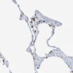 SEMA3F Antibody in Immunohistochemistry (Paraffin) (IHC (P))