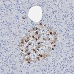 SEMA3F Antibody in Immunohistochemistry (Paraffin) (IHC (P))