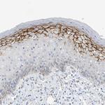 SEMA3F Antibody in Immunohistochemistry (Paraffin) (IHC (P))