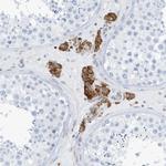 SEMA3F Antibody in Immunohistochemistry (Paraffin) (IHC (P))
