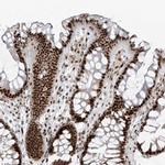 PCNP Antibody in Immunohistochemistry (Paraffin) (IHC (P))