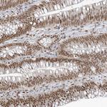 STAG1 Antibody in Immunohistochemistry (Paraffin) (IHC (P))