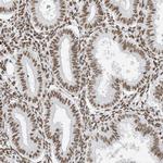 STAG1 Antibody in Immunohistochemistry (Paraffin) (IHC (P))
